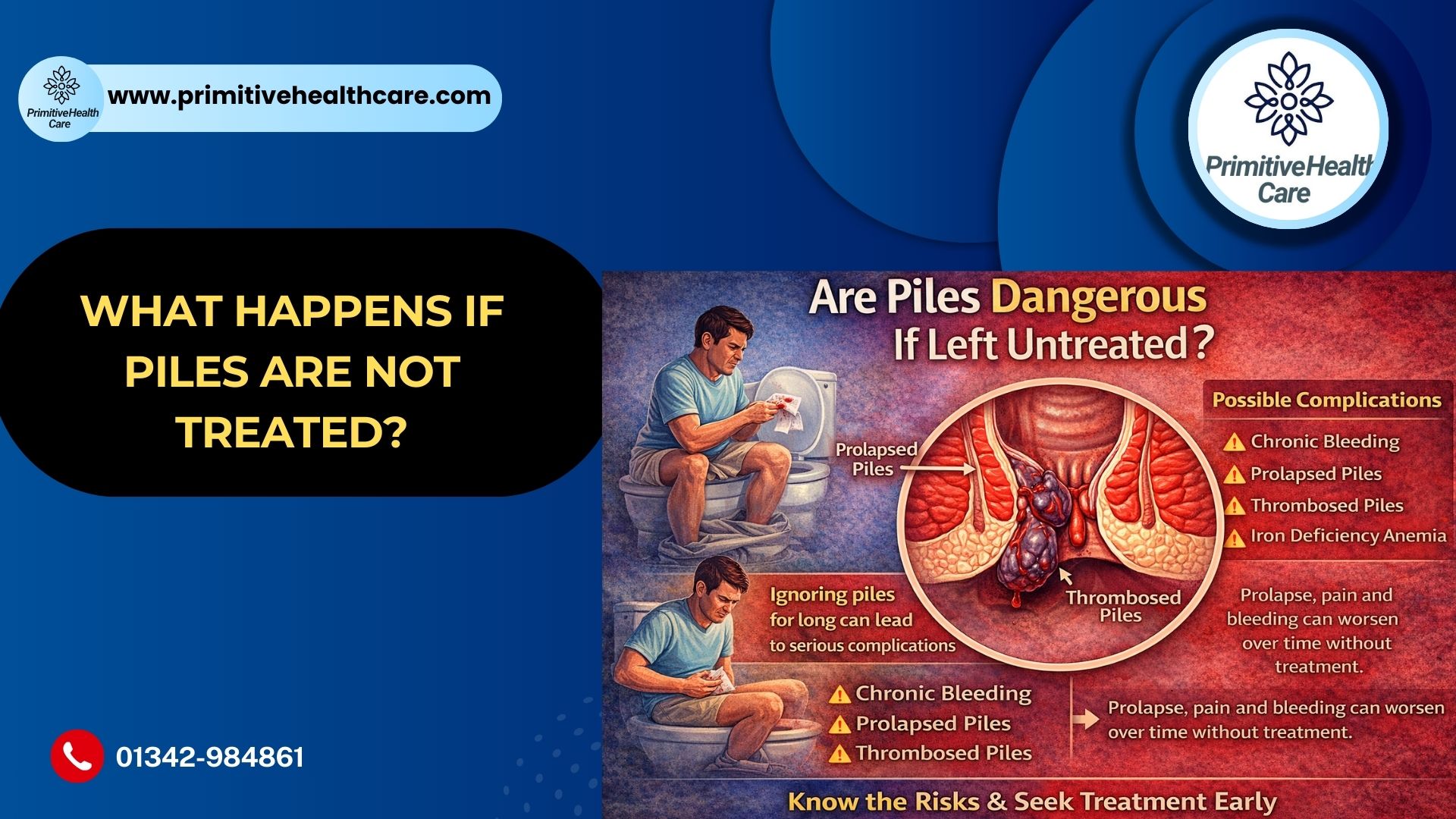 What Happens If Piles Are Not Treated?